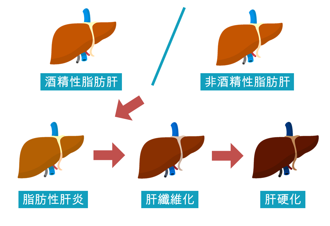 什麼是脂肪肝